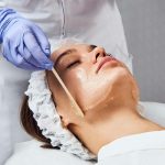 Chemical Peels and Sensitivity: What Beginners Should Know