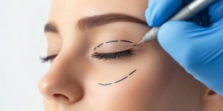 Blepharoplasty in Islamabad