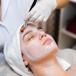 Chemical Peels in Oman: A Step-by-Step Overview for First-Timers