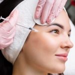 How Profhilo Treatment Helps Improve Skin Quality