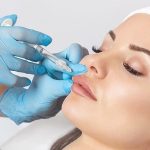 Are Fillers Effective for Non-Surgical Beauty Enhancements?