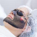 هل يُعدّ تقشير الكربون بالليزر مناسبًا لنوع بشرتك؟