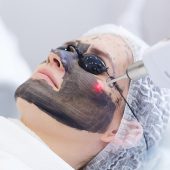 التقشير بالليزر الكربوني مسقط