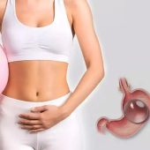 Gastric Balloon in Oman