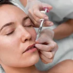 Are Dermal Fillers Safe? Benefits and Risks Explained