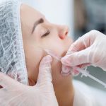 Dermatologists Answer Common Questions About Rosacea