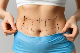 Liposuction Islamabad
