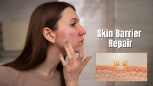 Skin Barrier