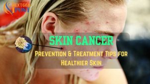 Skin Cancer Treatment
