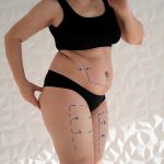 كيف تساعد عملية شفط الدهون في الحصول على قوام أكثر تناسقاً